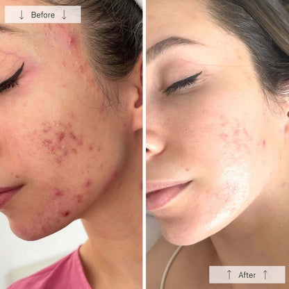 OMNILUX LED Clear Face